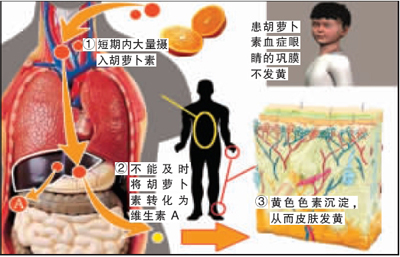 橘子吃太多　全身变橘黄色(图)